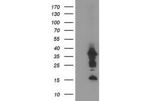 PDLIM2 anticorps