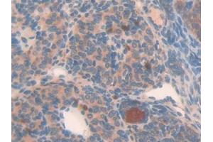 DAB staining on IHC-P; Samples: Mouse Placenta Tissue (NAIP Antikörper  (AA 500-759))