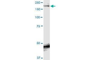 SCN9A monoclonal antibody (M01), clone 5A11. (SCN9A Antikörper  (AA 269-339))