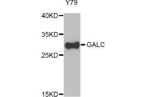 Western Blotting (WB) image for anti-Galactosylceramidase (GALC) (AA 40-300) antibody (ABIN1679950) (GALC Antikörper  (AA 40-300))