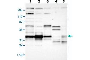 Western blot analysis of Lane 1: RT-4, Lane 2: U-251 MG, Lane 3: A-431, Lane 4: Liver, Lane 5: Tonsil with CCDC50 polyclonal antibody  at 1:250-1:500 dilution. (CCDC50 Antikörper)