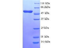 SDS-PAGE (SDS) image for Asialoglycoprotein Receptor 1 (ASGR1) (AA 61-284) protein (GST tag) (ABIN5709089)