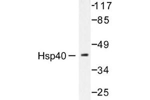 Image no. 2 for anti-DnaJ (Hsp40) Homolog, Subfamily B, Member 1 (DNAJB1) antibody (ABIN265471) (DNAJB1 Antikörper)