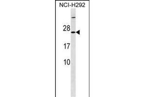 MRPS23 Antibody (Center) (ABIN1538455 and ABIN2849850) western blot analysis in NCI- cell line lysates (35 μg/lane). (MRPS23 Antikörper  (AA 50-76))
