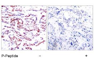 Image no. 1 for anti-Activating Transcription Factor 2 (ATF2) (pThr53), (pThr71) antibody (ABIN196666) (ATF2 Antikörper  (pThr53, pThr71))