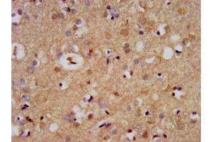 IHC image of ABIN7169072 diluted at 1:500 and staining in paraffin-embedded human brain tissue performed on a Leica BondTM system. (CDC42BPB Antikörper  (AA 1609-1711))