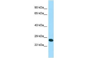 WB Suggested Anti-RAB41 Antibody Titration: 1.