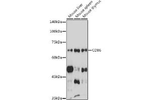Western blot analysis of extracts of various cell lines, using CD86 antibody (ABIN6131556, ABIN6138237, ABIN6138238 and ABIN6219508) at 1:1000 dilution. (CD86 Antikörper  (AA 30-247))