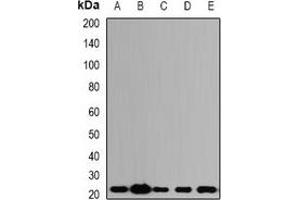 Western blot analysis of ALG-2 expression in SW620 (A), HepG2 (B), mouse kidney (C), mouse lung (D), rat ovary (E) whole cell lysates. (ALG2 Antikörper)
