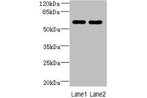 Western blot All lanes: ZNF215 antibody at 3 μg/mL Lane 1: Hela whole cell lysate Lane 2: A431 whole cell lysate Secondary Goat polyclonal to rabbit IgG at 1/10000 dilution Predicted band size: 61, 36 kDa Observed band size: 61 kDa (ZNF215 Antikörper  (AA 12-304))