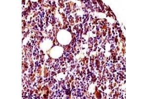 Immunohistochemistry (IHC) image for anti-V-Yes-1 Yamaguchi Sarcoma Viral Related Oncogene Homolog (LYN) (AA 1-30) antibody (ABIN3029563)