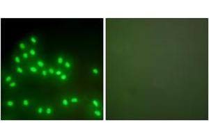 Immunofluorescence analysis of A549 cells, using Ku70/80 Antibody. (Ku70/80 (AA 683-732) Antikörper)