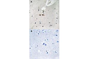 Immunohistochemical staining of human brain tissue by EFNB1/EFNB2/EFNB3 (phospho Y324) polyclonal antibody  without blocking peptide (A) or preincubated with blocking peptide (B) under 1:50-1:100 dilution. (Ephrin B1 Antikörper  (pTyr324))