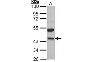 WB Image Sample (30 ug of whole cell lysate) A: Molt-4 , 10% SDS PAGE antibody diluted at 1:1000 (KNG1 Antikörper)