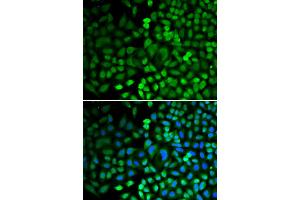 Immunofluorescence analysis of HeLa cells using APEX1 antibody (ABIN5970467). (APEX1 Antikörper)