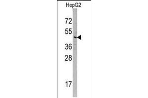 Western blot analysis of SNX6 Antibody in HepG2 cell line lysates (35ug/lane) (SNX6 Antikörper  (N-Term))