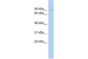 WB Suggested Anti-ZNF510 Antibody Titration:  0. (ZNF510 Antikörper  (N-Term))