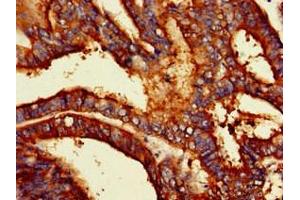 Immunohistochemistry (IHC) image for anti-Podocalyxin-Like (PODXL) (AA 32-458) antibody (ABIN7163724)