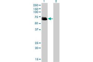 Western Blot analysis of RIPK2 expression in transfected 293T cell line by RIPK2 monoclonal antibody (M01), clone 2C7. (RIPK2 Antikörper  (AA 431-540))