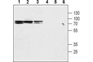 Western blot analysis of rat kidney membranes (lanes 1 and 4), mouse kidney lysates (lanes 2 and 5) and rat stomach lysates (lanes 3 and 6): - 1-3. (SLC9A2 Antikörper  (C-Term, Intracellular))