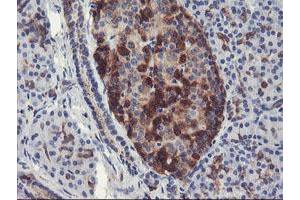 Immunohistochemical staining of paraffin-embedded Human pancreas tissue using anti-PFKP mouse monoclonal antibody. (PFKP Antikörper)