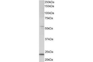 Image no. 1 for anti-MAX Dimerization Protein 4 (MXD4) (C-Term) antibody (ABIN374270) (MXD4 Antikörper  (C-Term))