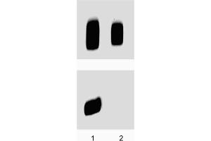 Western Blotting (WB) image for anti-Protein Kinase, CAMP-Dependent, Regulatory, Type II, beta (PRKAR2B) (pSer114) antibody (ABIN968875)