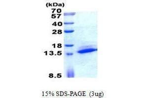 Figure annotation denotes ug of protein loaded and % gel used. (SAMD13 Protein)