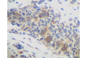 Image no. 3 for anti-Chemokine (C-X-C Motif) Ligand 14 (CXCL14) antibody (ABIN465239) (CXCL14 Antikörper)