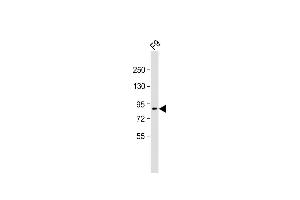 Anti-SUZ12 Antibody (C-term) at 1:2000 dilution + F9 whole cell lysate Lysates/proteins at 20 μg per lane. (SUZ12 Antikörper  (C-Term))