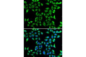 Immunofluorescence analysis of U2OS cells using DNAJA3 antibody (ABIN6292022). (DNAJA3 Antikörper)