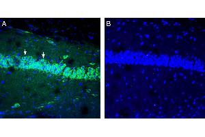Expression of IGF1 in mouse hippocampus. (IGF1 Antikörper  (Secreted))
