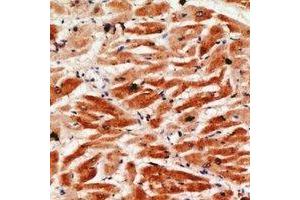 Immunohistochemical analysis of Granzyme A staining in human heart formalin fixed paraffin embedded tissue section.