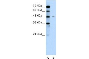 WB Suggested Anti-CHGA Antibody Titration:  0. (Chromogranin A Antikörper  (C-Term))
