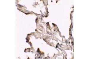 Immunohistochemistry (IHC) image for anti-Nibrin (NBN) (C-Term) antibody (ABIN1030542) (Nibrin Antikörper  (C-Term))