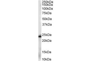 Western Blotting (WB) image for anti-Chromosome 11 Open Reading Frame 82 (C11orf82) (C-Term) antibody (ABIN2789390)