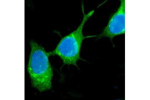 IF analysis of TFF1 using anti-TFF1 antibody (ABIN7602931).