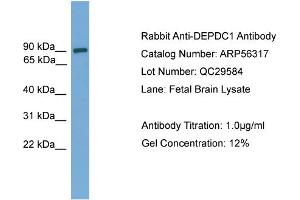 WB Suggested Anti-DEPDC1  Antibody Titration: 0. (DEPDC1 Antikörper  (Middle Region))
