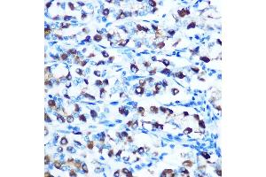 Immunohistochemistry of paraffin-embedded rat stomach using DMT1 Rabbit pAb (ABIN6129471, ABIN6147839, ABIN6147840 and ABIN6214400) at dilution of 1:100 (40x lens). (SLC11A2 Antikörper  (AA 1-100))
