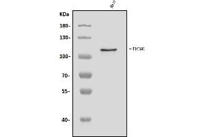 Western blot analysis of TRIF/TICAM1 using anti-TRIF/TICAM1 antibody (ABIN7601561).