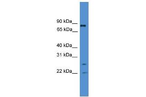 WB Suggested Anti-AKAP8L Antibody Titration:  0. (AKAP8L Antikörper  (Middle Region))
