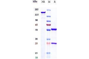 Anti-TFPI Reference Antibody (befovacimab) on SDS-PAGE under reducing (R) condition.