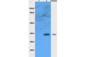 Lane 1: mouse liver lysates Lane 2: mouse thymus lysates probed with Anti CD1A Polyclonal Antibody, Unconjugated (ABIN1386771) at 1:200 in 4 °C. (CD1d1 Antikörper  (AA 165-270))