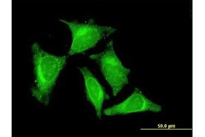 Immunofluorescence of monoclonal antibody to RASGEF1C on HeLa cell. (RASGEF1C Antikörper  (AA 168-260))