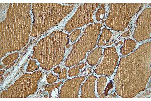 Immunohistochemistry (IHC) image for anti-Thyroglobulin (TG) (C-Term) antibody (ABIN7598886) (Thyroglobulin Antikörper  (C-Term))