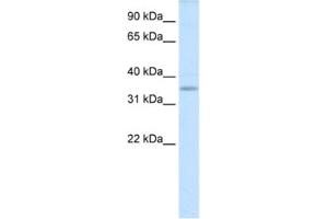 Western Blotting (WB) image for anti-TGFB-Induced Factor Homeobox 2-Like, X-Linked (TGIF2LX) antibody (ABIN2461543)