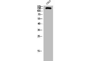 Western Blot analysis of COLO cells using SFRS15 Polyclonal Antibody (SCAF4 Antikörper  (Internal Region))