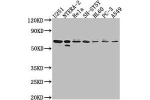 Western Blot Positive WB detected in: U251 whole cell lysate, NTERA-2 whole cell lysate, Hela whole cell lysate, SH-SY5Y whole cell lysate, HL60 whole cell lysate, PC-3 whole cell lysate, A549 whole cell lysate All lanes: CDK17 antibody at 1:2000 Secondary Goat polyclonal to rabbit IgG at 1/50000 dilution Predicted band size: 60 kDa Observed band size: 60 kDa (CDK17 Antikörper  (AA 337-523))