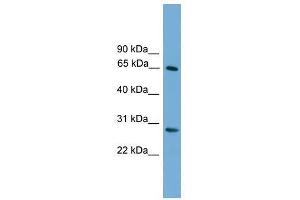 Western Blot showing FBXW8 antibody used at a concentration of 1-2 ug/ml to detect its target protein. (FBXW8 Antikörper  (Middle Region))