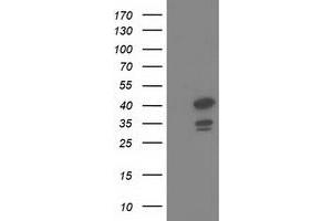 HEK293T cells were transfected with the pCMV6-ENTRY control (Left lane) or pCMV6-ENTRY DNAJB1 (Right lane) cDNA for 48 hrs and lysed. (DNAJB1 Antikörper)